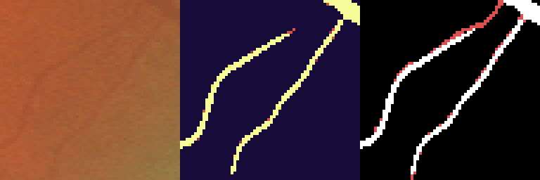 rNCA self-repairing segmentation